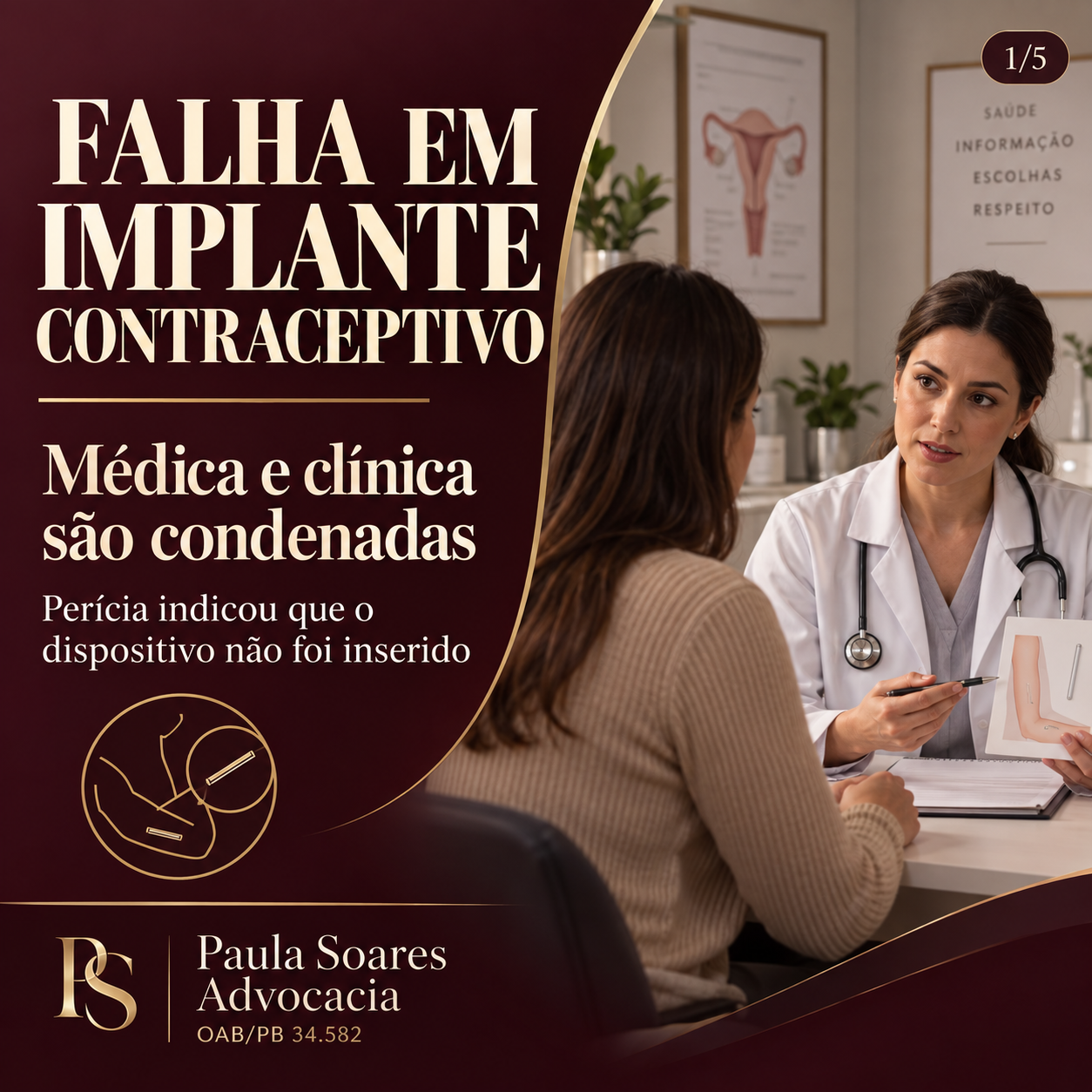 Falha em implante contraceptivo: médica e clínica são condenadas